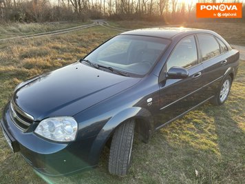 Chevrolet Lacetti, 2008, Газ пропан-бутан / Бензин, 1.8 л., 151 тис. км, Седан, Синій, Бердичів Cars-Pr-276245 фото